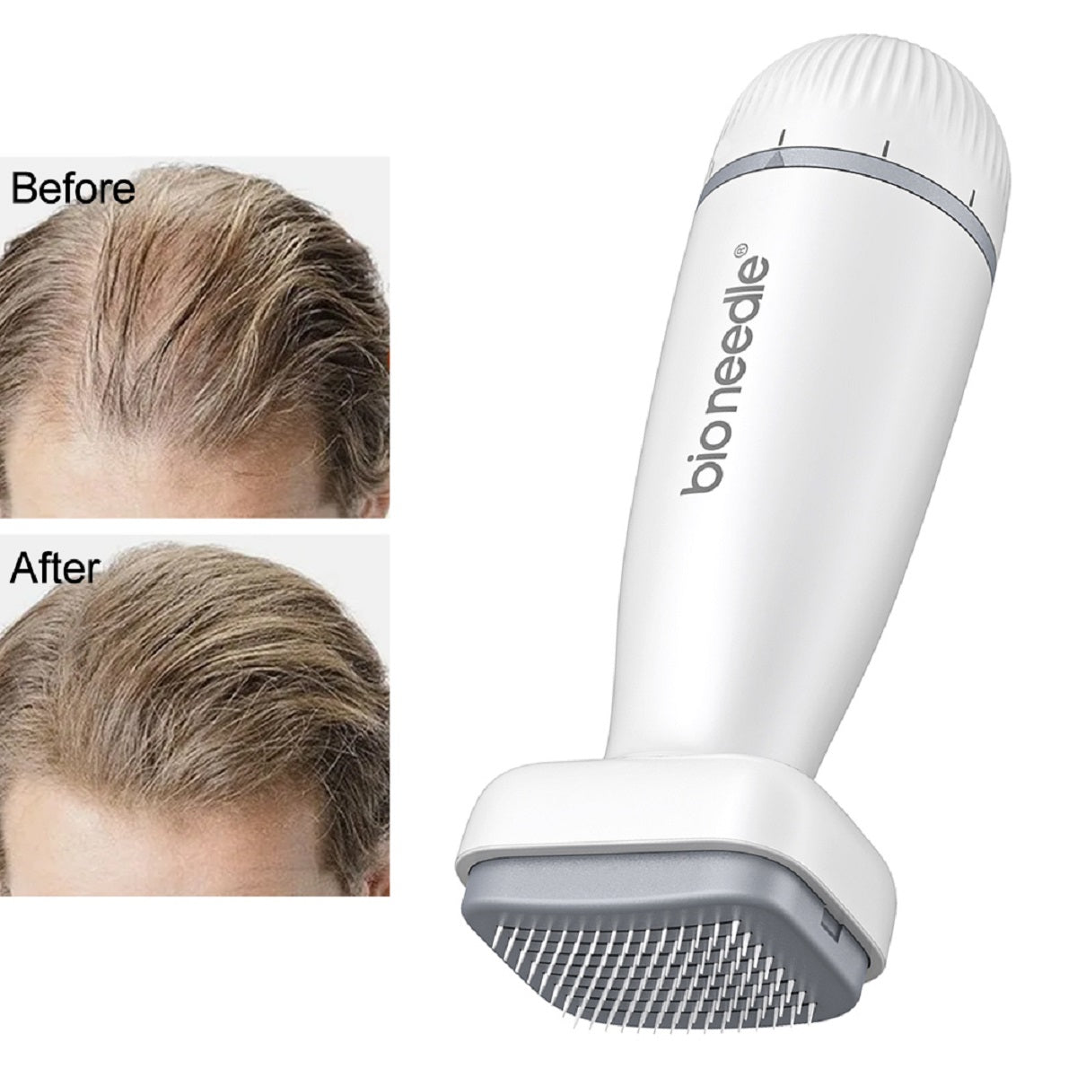 Derma Roller Stamp Microneedle for Hair Growth