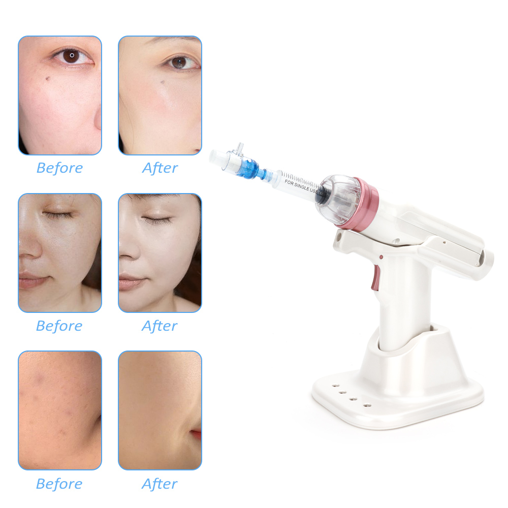Rechargeable At-Home Facial Care Device with Adjustable Settings