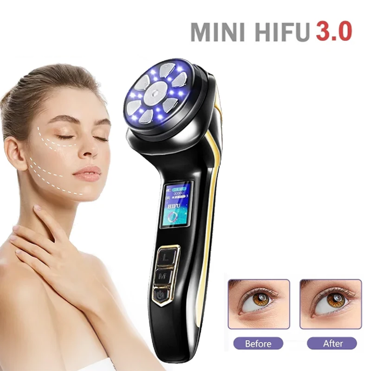 Microcurrent Facial Massage Device